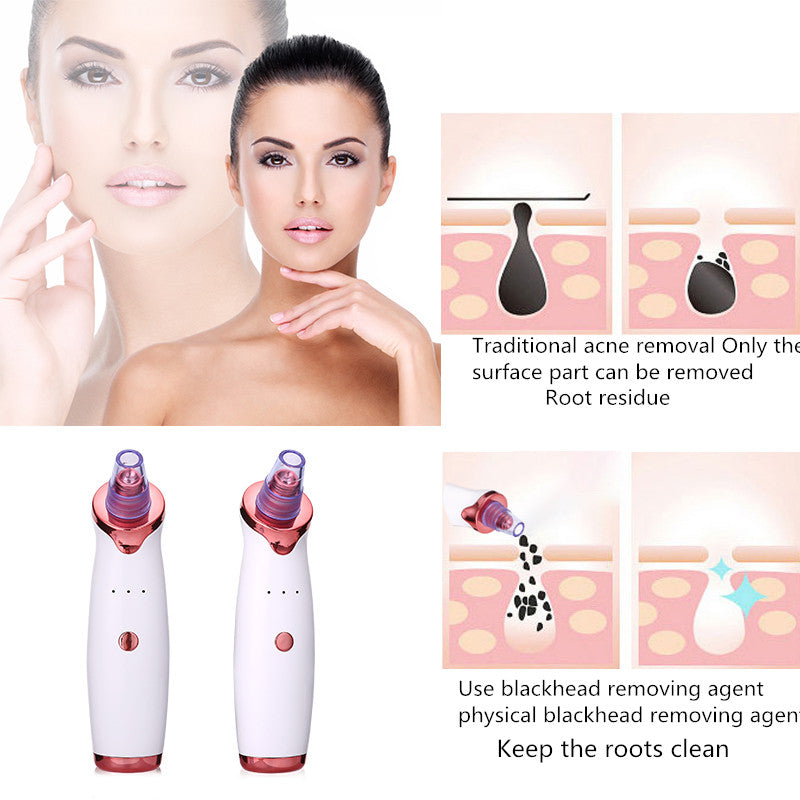 Pro Blackhead Vacuum: Deep Pore Cleansing Tool